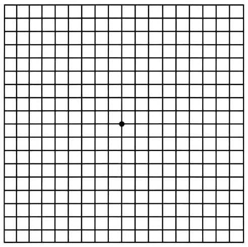 Amsler Grid  Carmelina Gordon, M.D.