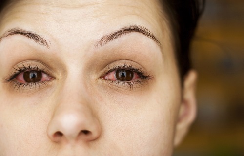 Coronavirus and Your Eyes