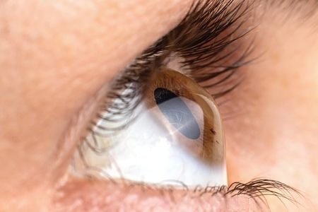 What Health Conditions Will Prevent Me From Receiving LASIK?