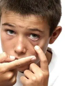 At What Age Can a Child Start Wearing Contact Lenses?