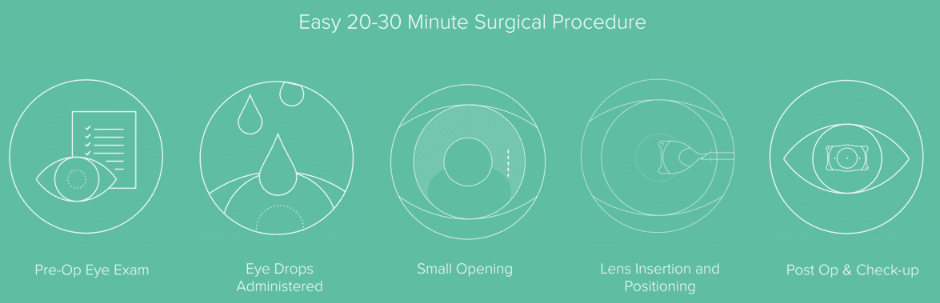 EVO Visian ICL 3 EVO Visian ICL Procedure 2