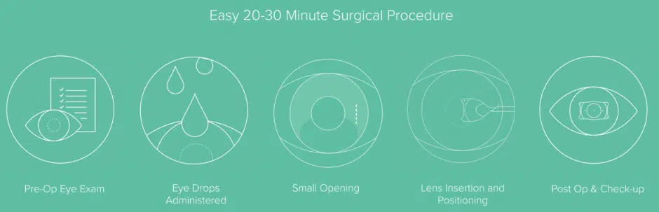 EVO Visian ICL Procedure 2