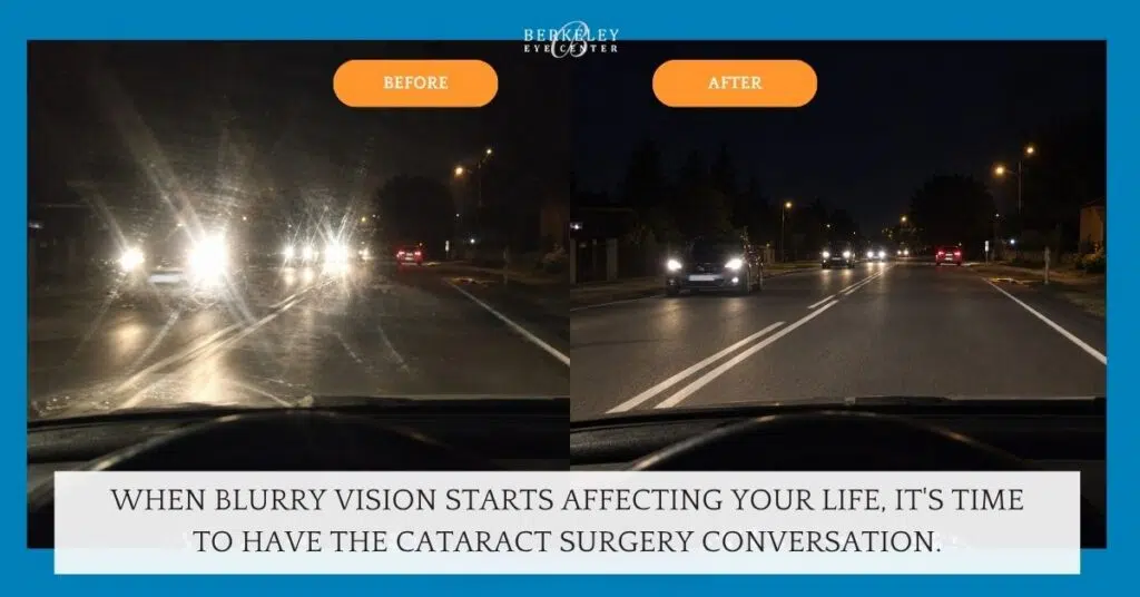 When Is the Right Time to Have Cataract Surgery? 1 When Is the Right Time to Have Cataract Surgery(1)