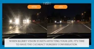 When Is the Right Time to Have Cataract Surgery? 1 When Is the Right Time to Have Cataract Surgery(1)