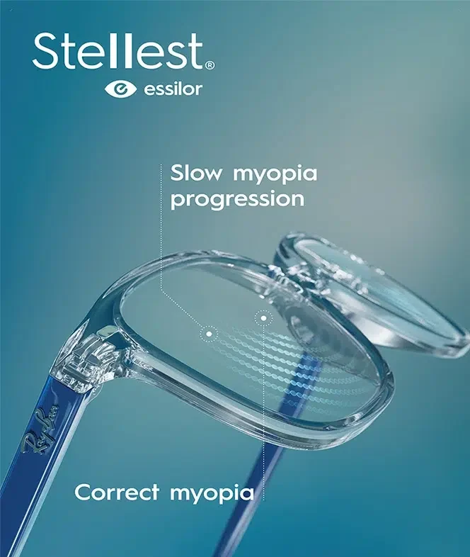 Myopia Control for Children 5 Stellest lenses Houston