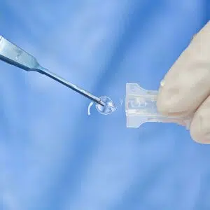 How to Choose the Right IOL for Cataract Surgery 1 How to Choose the Right IOL for Cataract Surgery
